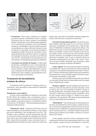Figura   2                                                         Figura   3
         Os cones
          vaginais
       facilitam a                                                      O pessário
 identificação e a                                                 vaginal “Introl”
     contração da                                                      eleva o colo
  musculatura do                                                            vesical.
   soalho pélvico.



     • Cistometria - Neste exame, estudam-se as variações          perder urina, a paciente foi orientada a aumentar progressiva-
       pressóricas durante o enchimento vesical e a micção.        mente o intervalo entre as micções em meia hora.
       Na primeira fase do exame, estuda-se a acomodação
       durante o enchimento vesical, denominada complacên-              Exercícios da musculatura pélvica - Os exercícios peri-
       cia. A ocorrência de contrações vesicais involuntárias      neais, também conhecidos como Exercícios de Kegel, são úteis
       caracteriza a instabilidade vesical (na ausência de doen-   tanto para o tratamento da IUE quanto para a urge-inconti-
       ça neurológica) ou a hiper-reflexia do detrusor (na sua     nência. Trabalhando inicialmente com pacientes idosas, o Dr.
       existência). A capacidade vesical funcional também é        Kegel observou que os exercícios melhoravam não só a conti-
       estudada nessa etapa. Do ponto de vista prático, a prin-    nência mas também o prazer sexual. Tratando-se de uma op-
       cipal informação da cistometria refere-se à existência      ção simples e barata, os exercícios são muito atraentes, porém
       de contrações involuntárias, presentes em até 40% dos       é preciso salientar a necessidade de motivação para a obten-
       casos de IUE, manifestando-se clinicamente pela enu-        ção de bons resultados, uma vez que os exercícios devem ser
       rese noturna e eventualmente pela urge-incontinência.       realizados constantemente e por toda a vida. Assim, o trata-
                                                                   mento exige do médico disposição para orientação e apoio
     • Associação com métodos de imagem - A observação             constante para conseguir resultados satisfatórios.
       da abertura e mobilidade do colo vesical utilizando a
       fluoroscopia ou o ultra-som durante as medidas pres-             Cones vaginais - Os cones vaginais (figura 2) melhoram
       sóricas constitui o estudo videourodinâmico, que per-       os resultados dos exercícios perineais não só pelo aumento da
       mite a obtenção de informações adicionais e é de im-        carga (peso), mas também aumentando a motivação. O princí-
       portância nos casos complexos, principalmente em ser-       pio é o mesmo utilizado pelos halterofilistas para aumentar a
       viços universitários de referência.                         massa muscular, ou seja, trabalhar progressivamente um gru-
                                                                   po muscular aumentando a carga usada.
Tratamento da incontinência                                             Estima-se que mais da metade das pacientes que utilizam
                                                                   os cones para fortalecimento da musculatura antes da cirurgia
urinária de esforço                                                ficam completamente curadas.
     O tratamento da IUE geralmente é cirúrgico, porém, re-             Pessários vaginais - Os mais modernos são feitos de si-
centemente, várias alternativas conservadoras de tratamento        licone na forma de uma pulseira com duas elevações. Como
vêm sendo propostas.                                               na maioria dos casos de incontinência urinária a bexiga se
                                                                   encontra prolapsada, a introdução do pessário na vagina eleva
Tratamentos conservadores                                          a bexiga e a uretra para a posição normal, simulando o efeito
     Existem várias modalidades de tratamento conservador          de uma cirurgia corretiva (figura 3). Admite-se que após a
da IUE. Dentre elas podemos citar o treinamento vesical, a         adaptação a esse tratamento, 80% das pacientes permaneçam
micção programada, os exercícios da musculatura pélvica, os        secas ou com melhora da incontinência.
cones vaginais, os pessários vaginais, os obturadores uretrais,
as técnicas de “biofeedback”, a eletroestimulação perineal e o           “Biofeedback” - Este método pode ser utilizado para tra-
tratamento medicamentoso.                                          tar tanto a incontinência de esforço quanto a urgência miccio-
                                                                   nal. A maioria dos equipamentos existentes possui um sensor
     Treinamento vesical - Funciona em diversos casos de           eletrônico que é introduzido na vagina para registrar a ativida-
urge-incontinência e de incontinência reflexa, ou seja, aquela     de dos músculos pélvicos, e eletrodos colados na parede ab-
que ocorre subitamente “sem sensação prévia ou aviso”. Por         dominal para monitorar sua atividade e informar se a muscu-
exemplo, vamos considerar o caso de uma paciente cujo diá-         latura está relaxada.
rio miccional mostrava períodos de continência de até duas
horas, após o que ocorria urgência miccional de forte intensi-          Assim, quando a paciente contrair corretamente a mus-
dade. A paciente foi orientada a urinar a cada duas horas, in-     culatura perineal haverá uma representação auditiva ou visual
dependentemente do desejo miccional. Após uma semana sem           (por exemplo, acender de luzes) informando se os músculos

                                                                                 GUIA PRÁTICO DE UROLOGIA                    281
 