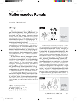 Capítulo 56
         Malformações Renais

         Frederico A. de Queiroz e Silva



         Introdução                                                            Figura   1
               O desenvolvimento normal dos rins depende de uma re-
         lação organogênica harmônica entre os brotos ureterais e os
         blastemas metanefrogênicos. Os brotos formarão todo o siste-
         ma coletor da urina, desde os ductos intra-renais de terceira                                                       Esquema de
         ordem até os meatos ureterais. Os blastemas darão origem a                                                          dicotomização
                                                                                                                             dos ductos
         todo o sistema que elabora a urina, ou seja, toda a população
                                                                                                                             coletores intra-
         de néfrons dos rins definitivos. Os parênquimas renais são,                                                         renais.
         portanto, constituídos de elementos originários dos blastemas
         metanefrogênicos e dos brotos ureterais.
               Interpretando o fato de haver ureter sem o rim corres-
         pondente e não haver rim sem o respectivo ureter, admite-se                Simultaneamente a esta migração ascendente e ipsilate-
         que os brotos ureterais são os elementos indutores do desen-         ral, os blastemas deverão rodar internamente em direção à
         volvimento dos blastemas, ou seja, estes não se desenvolvem          coluna. Completada esta ascensão helicoidal, os bacinetes que
         na ausência daqueles. Há provas de que anomalias do desen-           estavam nas faces anteriores dos rins primitivos na região pélvi-
         volvimento dos brotos acarretam malformações dos blaste-             ca se posicionam nas faces mediais dos rins definitivos na re-
         mas correspondentes e indícios de que existe uma relação de          gião lombar. Em cada rim identifica-se um pólo superior, ou-
         reciprocidade entre os dois, isto é, a normalidade de um inter-      tro inferior e, entre os mesmos, uma região mesorrenal. Du-
         feriria na do outro.                                                 rante o desenvolvimento, os pólos superiores ficam mais pró-
               No embrião normal há um par de brotos e de blastemas,          ximos entre si, de maneira que os eixos bipolares convergem
         ambos primitivamente localizados de cada lado da cloaca na           para a linha média num ponto que se situa acima dos rins.
         região pélvica. Os brotos crescem em sentido caudocranial                  Depois de todos esses eventos, os blastemas primitivos
         para formar os ureteres e dilatam-se na região lombar para dar       terão se transformado em rins definitivos, ou seja, órgãos con-
         origem aos bacinetes. Ao nível do parênquima, o bacinete             tínuos, independentes e que se posicionam nas regiões lomba-
         dicotomiza-se originando os cálices, e estes, já na intimidade       res abaixo das cúpulas diafragmáticas, sendo o direito um pou-
         do tecido, originam os ductos coletores intra-renais de pri-         co mais baixo que o esquerdo. Têm superfície lisa, e cada um
         meira, segunda e terceira ordem, seqüencialmente (figura 1).         exibe forma que lembra um grão de feijão, ou seja, uma face
               Sabe-se que os ductos coletores intra-renais induzem a dife-   convexa e outra côncava, sendo que nesta se identifica uma
         renciação das áreas dos blastemas adjacentes aos mesmos, fato        depressão, o hilo renal, por onde passam vasos, nervos e vias
         que confere aos rins primitivos um aspecto lobular, transitório.     excretoras. As artérias renais têm origem em cada lado da aor-
               Os blastemas metanefrogênicos são estruturas primitiva-        ta lombar, imediatamente abaixo da mesentérica superior, e as
         mente amorfas, contínuas e contíguas na região pélvica. Inde-        veias drenam para a cava inferior. No hilo e no sentido ântero-
         pendentes, acompanham o desenvolvimento dos brotos urete-
         rais respectivos. Durante a organogênese os dois blastemas de-
         verão manter continuidade e independência, migrando superi-
         ormente da região pélvica primitiva para a lombar definitiva          Figura   2
         (figura 2).


                                                                                                                             Esquema de
         Endereço para correspondência:                                                                                      migração dos
         Rua Joaquim Floriano, 243 - cjs. 41/42                                                                              rins da região
                                                                                                                             pélvica para a
         04534-010 - São Paulo - SP
                                                                                                                             lombar.
         Telefax: (0--11) 820-3146 / 829-6071

                                                                                            GUIA PRÁTICO DE UROLOGIA                      327


Cap 56 - Mal Renais.pm6            327                                                        13/06/00, 15:16
 