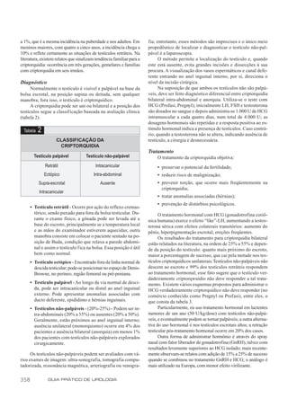 a 1%, que é a mesma incidência na puberdade e nos adultos. Em         fia; entretanto, esses métodos são imprecisos e o único meio
meninos maiores, com quatro a cinco anos, a incidência chega a        propedêutico de localizar e diagnosticar o testículo não-pal-
10% e reflete certamente as situações de testículos retráteis. Na     pável é a laparoscopia.
literatura, existem relatos que sinalizam tendência familiar para a         O método permite a localização do testículo e, quando
criptorquidia: ocorrência em três gerações, gemelares e famílias      este está ausente, evita grandes incisões e dissecções à sua
com criptorquidia em seis irmãos.                                     procura. A visualização dos vasos espermáticos e canal defe-
                                                                      rente entrando no anel inguinal interno, por si, direciona o
Diagnóstico                                                           nível da incisão cirúrgica.
      Normalmente o testículo é visível e palpável na base da               Na suposição de que ambos os testículos não são palpá-
bolsa escrotal, na posição supina ou deitada, sem qualquer            veis, deve ser feito diagnóstico diferencial entre criptorquidia
manobra; fora isso, o testículo é criptorquídico.                     bilateral intra-abdominal e anorquia. Utiliza-se o teste com
      A criptorquidia pode ser uni ou bilateral e a posição dos       HCG (Profasi, Pregnyl); inicialmente LH, FSH e testosterona
testículos segue a classificação baseada na avaliação clínica         são dosados no sangue e depois administra-se 1.000 U de HCG
(tabela 2).                                                           intramuscular a cada quatro dias, num total de 4.000 U; as
                                                                      dosagens hormonais são repetidas e a resposta positiva ao es-
 Tabela   2                                                           tímulo hormonal indica a presença de testículos. Caso contrá-
                                                                      rio, quando a testosterona não se altera, indicando ausência de
                    CLASSIFICAÇÃO DA                                  testículo, a cirurgia é desnecessária.
                     CRIPTORQUIDIA
                                                                      Tratamento
        Testículo palpável          Testículo não-palpável                 O tratamento da criptorquidia objetiva:
              Retrátil                    Intracanicular                   • preservar o potencial da fertilidade;
              Ectópico                   Intra-abdominal                   • reduzir risco de malignização;
          Supra-escrotal                    Ausente                        • prevenir torção, que ocorre mais freqüentemente na
                                                                             criptorquidia;
           Intracanicular
                                                                           • tratar anomalias associadas (hérnias);
                                                                           • prevenção de distúrbios psicológicos.
      • Testículo retrátil - Ocorre por ação do reflexo cremas-
        térico, sendo puxado para fora da bolsa testicular. Du-             O tratamento hormonal com HCG (gonadotrofina coriô-
        rante o exame físico, a gônada pode ser levada até a          nica humana) exerce o efeito “like”-LH, aumentando a testos-
        base do escroto, principalmente se a temperatura local        terona sérica com efeitos colaterais transitórios: aumento do
        e as mãos do examinador estiverem aquecidas; outra            pênis, hiperpigmentação escrotal, ereções freqüentes.
        manobra consiste em colocar o paciente sentado na po-               Os resultados do tratamento para criptorquidia bilateral
        sição de Buda, condição que relaxa a parede abdomi-           estão relatados na literatura, na ordem de 25% a 55% e depen-
        nal e assim o testículo fica na bolsa. Essa posição é útil    de da posição do testículo: quanto mais próximo do escroto,
        bem como normal.                                              maior a porcentagem de sucesso, que cai pela metade nos tes-
      • Testículo ectópico - Encontrado fora da linha normal de       tículos criptorquídicos unilaterais. Testículos não-palpáveis não
        descida testicular; pode-se posicionar no espaço de Denis-    descem ao escroto e 99% dos testículos retráteis respondem
        Browne, no períneo, região femoral ou pré-peniana.            ao tratamento hormonal; esse fato sugere que o testículo ver-
                                                                      dadeiramente criptorqwuídio não deve responder a tal trata-
      • Testículo palpável - Ao longo da via normal de desci-         mento. Existem vários esquemas propostos para administrar o
        da, pode ser intracanicular ou distal ao anel inguinal        HCG verdadeiramente criptorquídico não deve responder (no
        externo. Pode apresentar anomalias associadas com             comércio conhecido como Pregnyl ou Profasi), entre eles, o
        ducto deferente, epidídimo e hérnias inguinais.               que consta da tabela 3.
      • Testículos não-palpáveis - (20%-25%) - Podem ser in-                Particularmente, eu uso tratamento hormonal em lactentes
        tra-abdominais (20% a 55%) ou ausentes (20% a 50%).           menores de um ano (50 U/kg/dose) com testículos não-palpá-
        Geralmente, estão próximos ao anel inguinal interno;          veis, e eventualmente podem se tornar palpáveis; a outra alterna-
        ausência unilateral (monorquismo) ocorre em 4% dos            tiva do uso hormonal é nos testículos escrotais altos; a retração
        pacientes e ausência bilateral (anorquia) em menos 1%         testicular pós-tratamento hormonal ocorre em 20% dos casos.
        dos pacientes com testículos não-palpáveis explorados               Outra forma de administrar hormônio é através do spray
        cirurgicamente.                                               nasal com fator liberador de gonadotrofina (GnRH), talvez com
                                                                      resultados levemente superiores ao HCG isolado; mais recente-
      Os testículos não-palpáveis podem ser avaliados com vá-         mente observam-se relatos com adição de 15% a 25% de sucesso
rios exames de imagem: ultra-sonografia, tomografia compu-            quando se combinou no tratamento GnRH e HCG; o análogo é
tadorizada, ressonância magnética, arteriografia ou venogra-          mais utilizado na Europa, com menor efeito virilizante.

358             GUIA PRÁTICO DE UROLOGIA
 