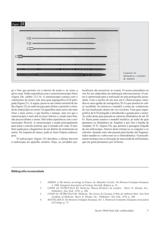 Figura   24




                                                                                                            Conjunto de
                                                                                                            dilatadores e bainhas
                                                                                                            de Amplatz.



go e fino que permite ver o interior do ureter e, às vezes, a       localiciais são acessíveis ao exame. O acesso percutâneo ao
pelve renal. Tenho experiência com o ureterorrenoscópio Storz       rim foi um subproduto da radiologia intervencionista. O ure-
(figura 20), calibre 12,5 Fr. A ureteroscopia começa com o          ter é cateterizado para a realização de uma pielografia ascen-
cateterismo do ureter com uma guia angiográfica 0,38 pole-          dente. Com o auxílio de um arco em C (fluoroscopia), intro-
gada (figura 21). A seguir, passa-se um cateter ureteral de ba-     duz-se uma agulha de aortografia (TLA) que penetra no cáli-
lão (figura 22) ao redor da guia para dilatar e permitir a entra-   ce escolhido. Ao retirar-se o mandril, a urina sai, comprovan-
da do endoscópio no ureter. Os aparelhos mais novos são mais        do sua localização dentro da via excretora. Uma guia angio-
finos e mais curtos, o que facilita o manejo, uma vez que o         gráfica de 0,38 polegada é introduzida e guiada para o ureter.
ureteroscópio é mais útil no terço inferior e, sendo mais fino,     Ao redor desta guia passam-se cateteres dilatadores de até 10
não precisa dilatar o ureter. Não tenho experiência com o ure-      Fr. Neste ponto usamos o mandril metálico, ao redor do qual
teroscópio flexível. A ureteroscopia é usada principalmente         passamos os dilatadores de Amplatz e por fim a bainha de
para tratar o cálculo ureteral, que é retirado sob visão. É tam-    Amplatz 33 Fr. (figura 24), que permite a passagem folgada
bém usada para o diagnóstico de um defeito de enchimento no         de um nefroscópio. Através deste retiram-se os coágulos e os
ureter. Na suspeita de tumor, pode-se fazer biópsia endoscó-        cálculos. Quando estes não passam pela bainha são fragmen-
pica.                                                               tados usando-se o ultra-som ou o eletroidráulico. O procedi-
      O nefroscópio (figura 23) derrubou a última bar reira         mento termina com a colocação de uma sonda de nefrostomia,
à endoscopia do aparelho urinário. Hoje, as cavidades pie-          que em geral permanece por 24 horas.




Bibliografia recomendada


                            1.     JARDIN A. The history of urology in France. In: Mattelaer JJ (ed.). De Historia Urologiae Europeae
                                      3. 1996. European Association of Urology. Kortrijk, Bélgica, p. 16.
                            2.     LYONS AS, PETRUCELLI RJ. Medicine. Museu Britânico de Londres. Harry N. Abrams, Inc.,
                                      Publishers, New York, 1978, p. 396.
                            3.     LYONS AS, PETRUCELLI RJ. Medicine. Dez Livros de Cirurgia (1564), de Ambroisi Paré. New York
                                      Academy of Medicine. Harry N. Abrams, Inc., Publishers, New York, 1978, p. 396.
                            4.     MATTELAER JJ. De Historia Urologiae Europeae, Vol. 3. Historical Committee European Association
                                      of Urology, p. 17.


                                                                                GUIA PRÁTICO DE UROLOGIA                            7
 