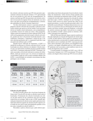 dos cálculos calicinais mostrou que 68% dos pacientes apre-        senta índices mais baixos de pacientes livres de cálculo e maior
          sentaram sintomas de infecção urinária e 51% apresentaram          índice de retratamento. Várias técnicas foram tentadas para
          dor em um período de cinco anos de acompanhamento. Os              melhorar a eliminação de fragmentos após a LEOC, entre elas
          autores concluem que 80% dos pacientes com cálculos calici-        a terapia de inversão (onde o paciente era colocado de cabeça
          nais irá necessitar de alguma forma de tratamento em cinco         para baixo após a LEOC), instilação de soro fisiológico no
          anos e que após este período de acompanhamento, a elimina-         sistema coletor através de cateter ureteral tipo cobra ou por
          ção espontânea do cálculo é bastante improvável.                   punção percutânea, e sessões de punho percussão sobre o rim
               Um fato relativamente comum é o paciente portador de          submetido ao procedimento. Nenhuma destas técnicas teve uso
          pequenos cálculos calicinais não associados a infecção ou obs-     clínico ou se mostrou eficaz na diminuição do número de pa-
          trução urinária que queixa-se de dor lombar. Esses pacientes       cientes com litíase residual. Apesar de freqüente, a colocação
          devem ser tratados conservadoramente, com acompanhamen-            de cateteres ureterais tipo duplo-J não previne as complica-
          to periódico através de exames de urina e ultra-sonografia.        ções secundárias à LEOC e parece piorar os sintomas e difi-
          Alguns centros de tratamento de litíase indicam LEOC do cál-       cultar a passagem dos fragmentos.
          culo (ou do grupamento calicinal no qual o cálculo está conti-           Além do fator gravitacional, alguns aspectos anatômicos
          do, quando este não é eficazmente localizado durante o pro-        têm sido implicados na retenção de fragmentos de cálculo após
          cedimento). Entretanto, é importante a noção de que o cál-         a LEOC no pólo inferior. Nosso grupo foi o primeiro na lite-
          culo calicinal geralmente não é o responsável pela dor e que       ratura internacional a correlacionar os achados anatômicos do
          esta pode não melhorar após a LEOC.                                pólo inferior com os resultados da LEOC. A presença de múl-
               Quando houver indicação de tratamento, a LEOC é o             tiplos cálices drenando o pólo inferior, um infundíbulo longo
          método de escolha para os cálculos calicinais de até 2 cm não      e estreito e um ângulo infundíbulo-pélvico (AIP) menor que
          localizados nos cálices inferiores (ver adiante). Cálculos maio-   90º poderiam estar associados a uma tendência maior de re-
          res que 2 cm apresentam resultados precários quando tratados       tenção de fragmentos após a LEOC.
          com LEOC e constituem indicação de NLPC. Entretanto, cál-                Correlacionando os resultados da LEOC com o AIP em
          culos associados a divertículo calicinal ou estenose de infun-     74 pacientes, Sampaio et al. (1997) encontraram 74% dos pa-
          díbulo, ainda que menores que 2 cm, devem ser tratados por         cientes com ângulo obtuso (maior que 90º) livres de cálculo.
          via percutânea, tendo em vista os maus resultados obtidos com
          LEOC e a possibilidade de resolução concomitante das duas
          patologias a um só tempo.
                                                                                                                                 Figura   1
            Tabela     1
              PORCENTAGEM DE PACIENTES LIVRES DE CÁLCULO /
             PORCENTAGEM DE RETRATAMENTO PARA CÁLCULOS EM
               DIFERENTES LOCALIZAÇÕES DO SISTEMA COLETOR
            Tamanho          Pelve            Cálice    Cálice     Cálice                                       Desenho esquemático
            do cálculo       renal           superior   médio     inferior                                      de um molde do sistema
                                                                                                                coletor de um rim direito,
              ≤ 10 mm        90 / 3          77 / 30    80 / 4     80 / 1                                       mostrando um cálculo
                                                                                                                contido num cálice que
             11-20 mm        83 / 7           75 / 6    71 / 9    58 / 38                                       forma com a pelve renal um
                                                                                                                ângulo maior que 90º (θ).
              > 20 mm        81 / 14         67 / 27    50 / 50   32 / 22
                                                                                                                                 Figura   2

          Cálculos do pólo inferior
                Os cálices do pólo inferior são o local mais freqüente de
          litíase renal. Cerca de 48% de todos os cálculos renais estão aí
          localizados. O tratamento dos cálculos localizados nos cáli-                                          Desenho esquemático
          ces do pólo inferior do rim constituem uma área de grande                                             de um molde do sistema
          controvérsia em urologia. Sabe-se que a LEOC quando apli-                                             coletor de um rim direito,
          cada para tratamento de cálculos nessa região apresenta resul-                                        mostrando um cálculo
          tados bem inferiores àqueles de cálculos do pólo superior, ter-                                       contido num cálice que
          ço médio do rim e pelve renal, principalmente quando se leva                                          forma com a pelve renal um
          em conta o tamanho do cálculo (tabela 1).                                                             ângulo menor que 90º (θ).
                Pela tabela 1 pode-se observar que o pólo inferior apre-


          100               GUIA PRÁTICO DE UROLOGIA



Cap 18- Litiase renal.pm6              100                                                  13/06/00, 15:08
 