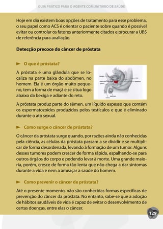 GUIA PRÁTICO PARA O AGENTE COMUNITÁRIO DE SAÚDE



Hoje em dia existem boas opções de tratamento para esse problema,
o seu papel como ACS é orientar o paciente sobre quando é possível
evitar ou controlar os fatores anteriormente citados e procurar a UBS
de referência para avaliação.

Detecção precoce do câncer de próstata


    O que é próstata?
A próstata é uma glândula que se lo-
caliza na parte baixa do abdômen, no
homem. Ela é um órgão muito peque-
no, tem a forma de maçã e se situa logo
abaixo da bexiga e adiante do reto.
A próstata produz parte do sêmen, um líquido espesso que contém
os espermatozoides produzidos pelos testículos e que é eliminado
durante o ato sexual.

    Como surge o câncer de próstata?
O câncer da próstata surge quando, por razões ainda não conhecidas
pela ciência, as células da próstata passam a se dividir e se multipli-
car de forma desordenada, levando à formação de um tumor. Alguns
desses tumores podem crescer de forma rápida, espalhando-se para
outros órgãos do corpo e podendo levar à morte. Uma grande maio-
ria, porém, cresce de forma tão lenta que não chega a dar sintomas
durante a vida e nem a ameaçar a saúde do homem.

    Como prevenir o câncer de próstata?
Até o presente momento, não são conhecidas formas específicas de
prevenção do câncer da próstata. No entanto, sabe-se que a adoção
de hábitos saudáveis de vida é capaz de evitar o desenvolvimento de
certas doenças, entre elas o câncer.
                                                                          129
 