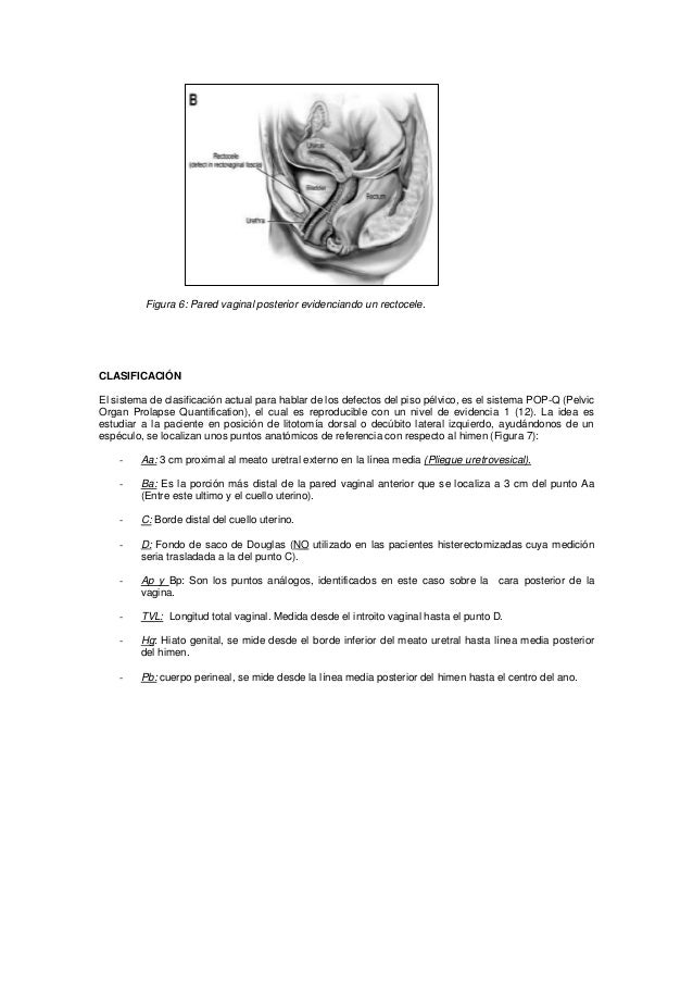 Guia prolapso genital husi 2011