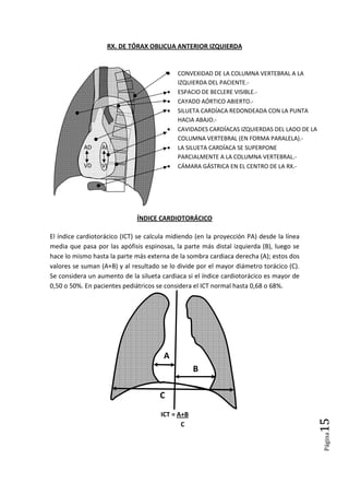 Página15
RX. DE TÓRAX OBLICUA ANTERIOR IZQUIERDA
ÍNDICE CARDIOTORÁCICO
El índice cardiotorácico (ICT) se calcula midiendo (en la proyección PA) desde la línea
media que pasa por las apófisis espinosas, la parte más distal izquierda (B), luego se
hace lo mismo hasta la parte más externa de la sombra cardiaca derecha (A); estos dos
valores se suman (A+B) y al resultado se lo divide por el mayor diámetro torácico (C).
Se considera un aumento de la silueta cardiaca si el índice cardiotorácico es mayor de
0,50 o 50%. En pacientes pediátricos se considera el ICT normal hasta 0,68 o 68%.
ICT = A+B
C
A
B
C
• CONVEXIDAD DE LA COLUMNA VERTEBRAL A LA
IZQUIERDA DEL PACIENTE.-
• ESPACIO DE BECLERE VISIBLE.-
• CAYADO AÓRTICO ABIERTO.-
• SILUETA CARDÍACA REDONDEADA CON LA PUNTA
HACIA ABAJO.-
• CAVIDADES CARDÍACAS IZQUIERDAS DEL LADO DE LA
COLUMNA VERTEBRAL (EN FORMA PARALELA).-
• LA SILUETA CARDÍACA SE SUPERPONE
PARCIALMENTE A LA COLUMNA VERTEBRAL.-
• CÁMARA GÁSTRICA EN EL CENTRO DE LA RX.-
AD AI
VD VI
 