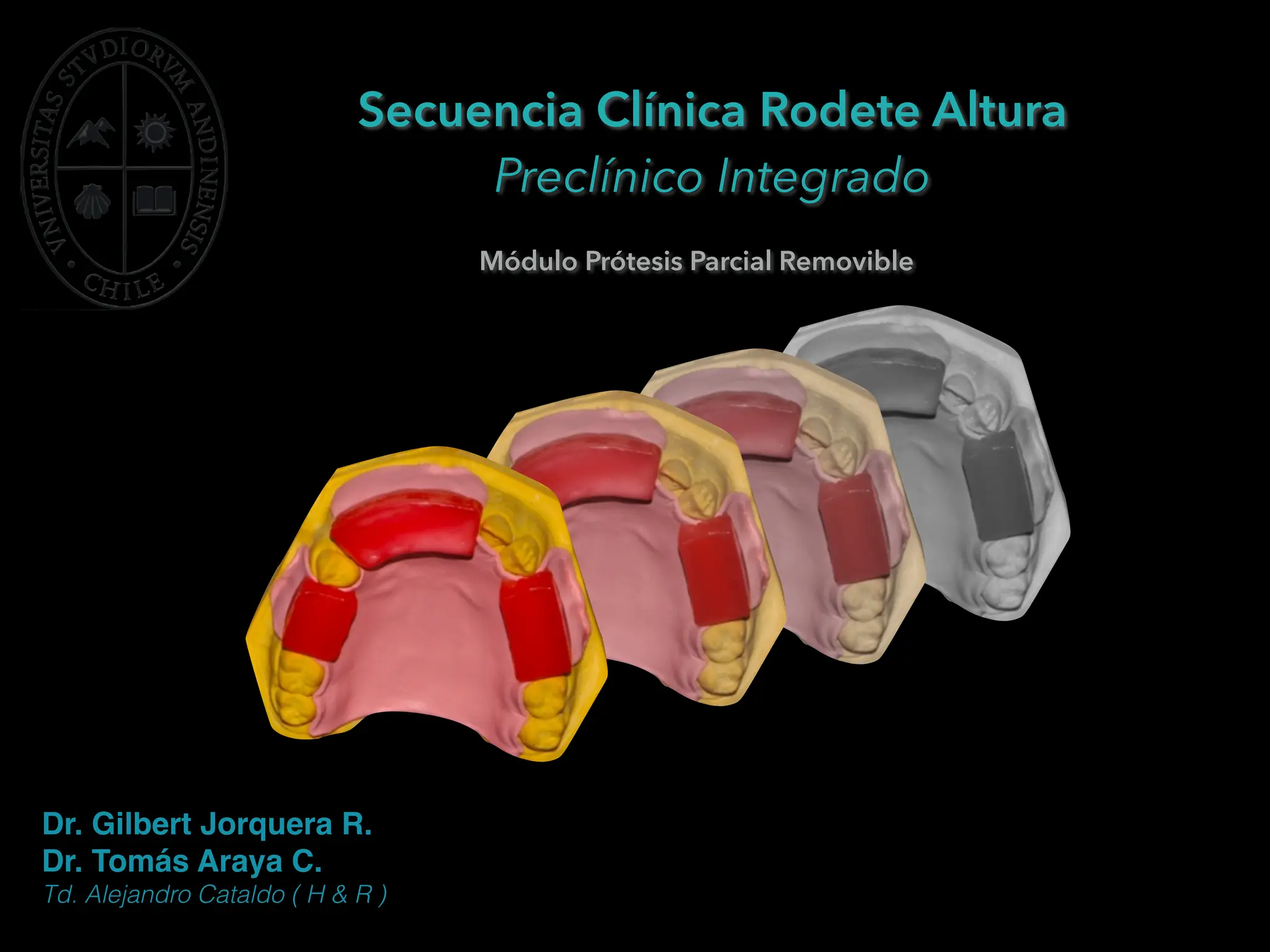 Guia rodetes de altura prótesis parcial.pdf