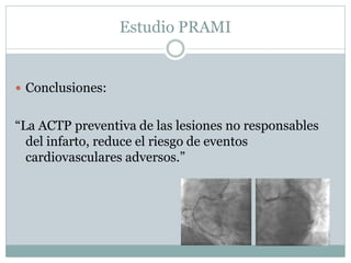 Estudio PRAMI
 Conclusiones:
“La ACTP preventiva de las lesiones no responsables
del infarto, reduce el riesgo de eventos
cardiovasculares adversos.”
 