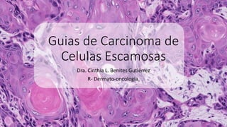 Guias de Carcinoma de
Celulas Escamosas
Dra. Cinthia L. Benites Gutiérrez
R- Dermato-oncología
 