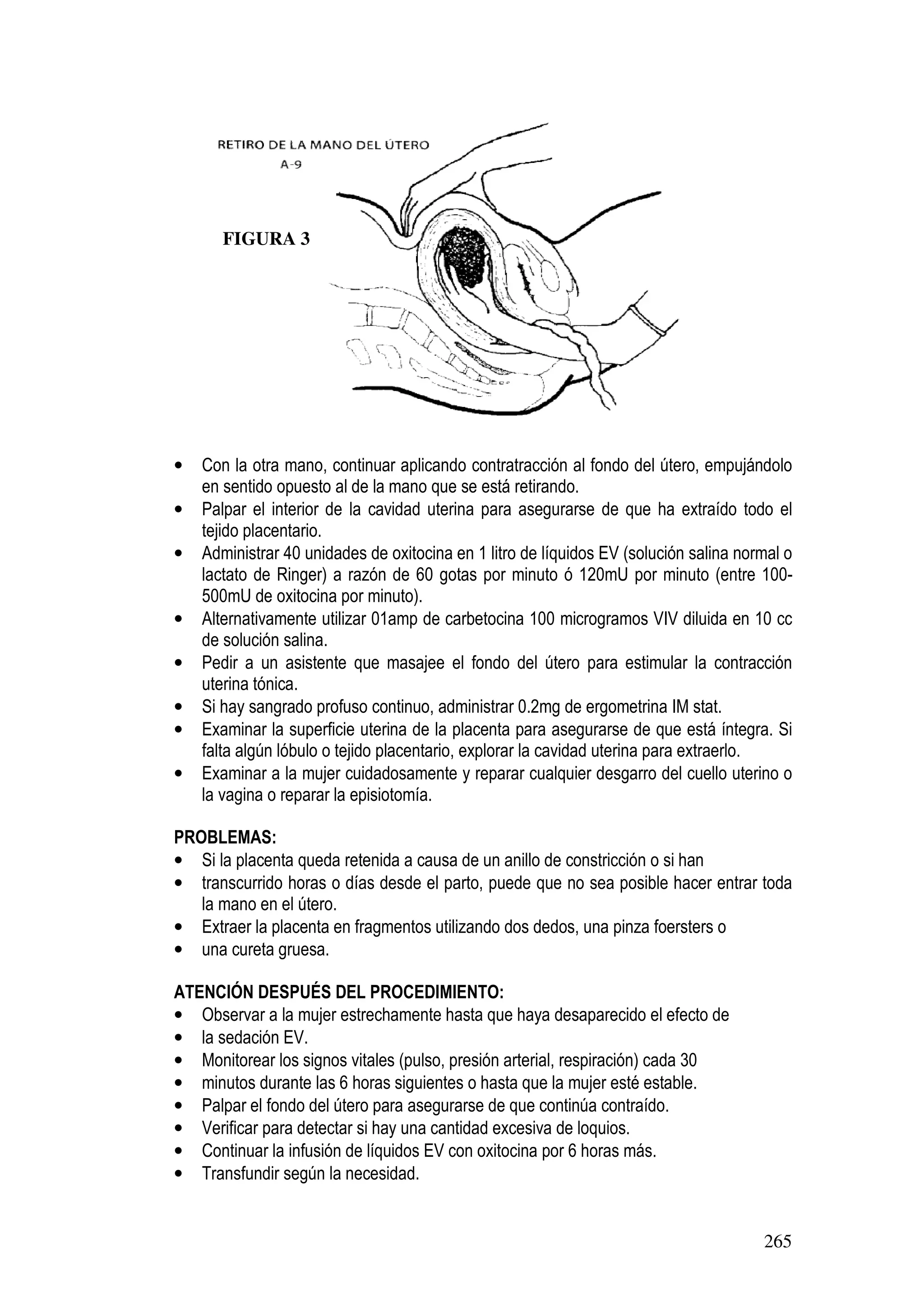 265
• Con la otra mano, continuar aplicando contratracción al fondo del útero, empujándolo
en sentido opuesto al de la mano que se está retirando.
• Palpar el interior de la cavidad uterina para asegurarse de que ha extraído todo el
tejido placentario.
• Administrar 40 unidades de oxitocina en 1 litro de líquidos EV (solución salina normal o
lactato de Ringer) a razón de 60 gotas por minuto ó 120mU por minuto (entre 100-
500mU de oxitocina por minuto).
• Alternativamente utilizar 01amp de carbetocina 100 microgramos VIV diluida en 10 cc
de solución salina.
• Pedir a un asistente que masajee el fondo del útero para estimular la contracción
uterina tónica.
• Si hay sangrado profuso continuo, administrar 0.2mg de ergometrina IM stat.
• Examinar la superficie uterina de la placenta para asegurarse de que está íntegra. Si
falta algún lóbulo o tejido placentario, explorar la cavidad uterina para extraerlo.
• Examinar a la mujer cuidadosamente y reparar cualquier desgarro del cuello uterino o
la vagina o reparar la episiotomía.
PROBLEMAS:
• Si la placenta queda retenida a causa de un anillo de constricción o si han
• transcurrido horas o días desde el parto, puede que no sea posible hacer entrar toda
la mano en el útero.
• Extraer la placenta en fragmentos utilizando dos dedos, una pinza foersters o
• una cureta gruesa.
ATENCIÓN DESPUÉS DEL PROCEDIMIENTO:
• Observar a la mujer estrechamente hasta que haya desaparecido el efecto de
• la sedación EV.
• Monitorear los signos vitales (pulso, presión arterial, respiración) cada 30
• minutos durante las 6 horas siguientes o hasta que la mujer esté estable.
• Palpar el fondo del útero para asegurarse de que continúa contraído.
• Verificar para detectar si hay una cantidad excesiva de loquios.
• Continuar la infusión de líquidos EV con oxitocina por 6 horas más.
• Transfundir según la necesidad.
FIGURA 3
 