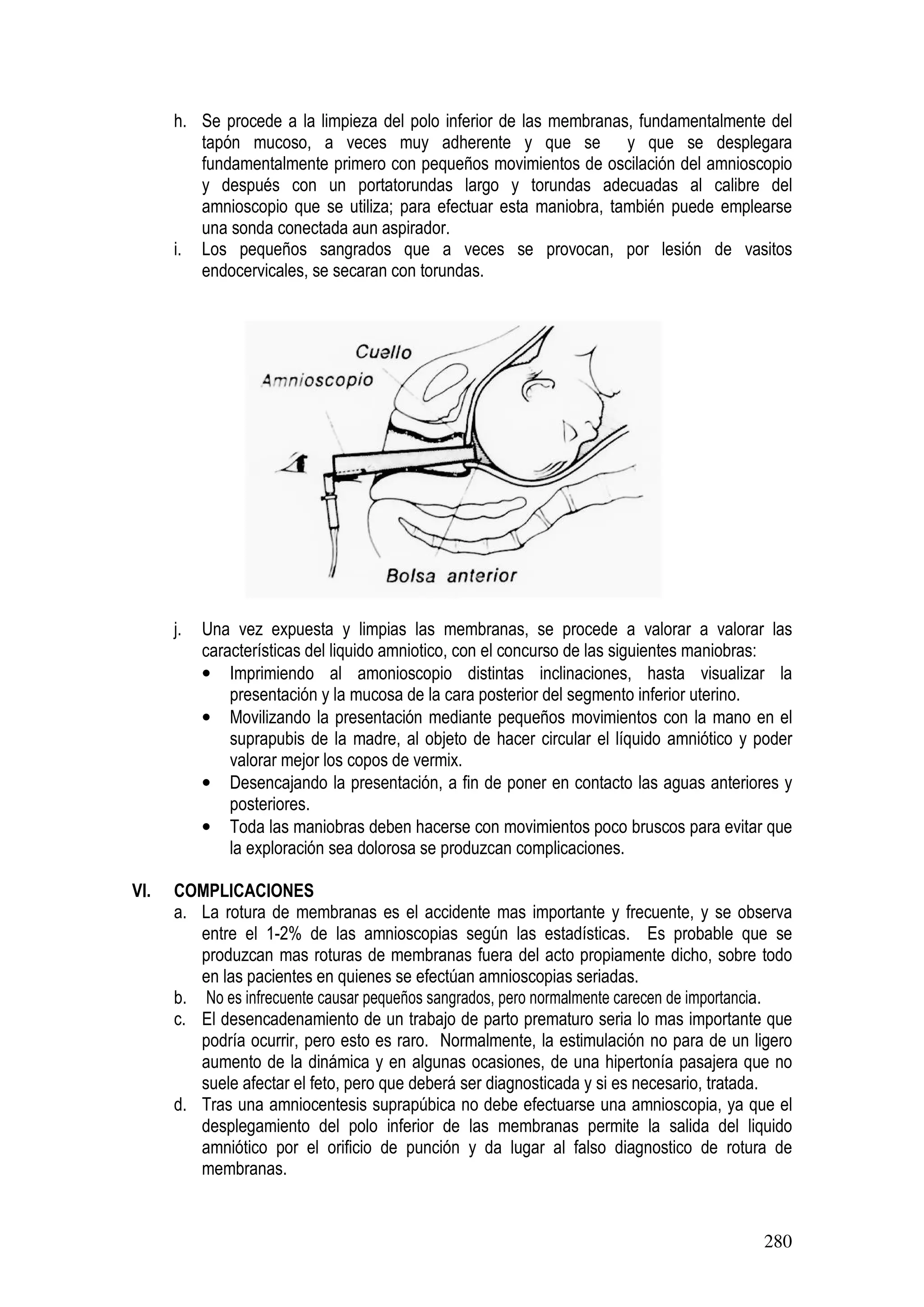 280
h. Se procede a la limpieza del polo inferior de las membranas, fundamentalmente del
tapón mucoso, a veces muy adherente y que se y que se desplegara
fundamentalmente primero con pequeños movimientos de oscilación del amnioscopio
y después con un portatorundas largo y torundas adecuadas al calibre del
amnioscopio que se utiliza; para efectuar esta maniobra, también puede emplearse
una sonda conectada aun aspirador.
i. Los pequeños sangrados que a veces se provocan, por lesión de vasitos
endocervicales, se secaran con torundas.
j. Una vez expuesta y limpias las membranas, se procede a valorar a valorar las
características del liquido amniotico, con el concurso de las siguientes maniobras:
• Imprimiendo al amonioscopio distintas inclinaciones, hasta visualizar la
presentación y la mucosa de la cara posterior del segmento inferior uterino.
• Movilizando la presentación mediante pequeños movimientos con la mano en el
suprapubis de la madre, al objeto de hacer circular el líquido amniótico y poder
valorar mejor los copos de vermix.
• Desencajando la presentación, a fin de poner en contacto las aguas anteriores y
posteriores.
• Toda las maniobras deben hacerse con movimientos poco bruscos para evitar que
la exploración sea dolorosa se produzcan complicaciones.
VI. COMPLICACIONES
a. La rotura de membranas es el accidente mas importante y frecuente, y se observa
entre el 1-2% de las amnioscopias según las estadísticas. Es probable que se
produzcan mas roturas de membranas fuera del acto propiamente dicho, sobre todo
en las pacientes en quienes se efectúan amnioscopias seriadas.
b. No es infrecuente causar pequeños sangrados, pero normalmente carecen de importancia.
c. El desencadenamiento de un trabajo de parto prematuro seria lo mas importante que
podría ocurrir, pero esto es raro. Normalmente, la estimulación no para de un ligero
aumento de la dinámica y en algunas ocasiones, de una hipertonía pasajera que no
suele afectar el feto, pero que deberá ser diagnosticada y si es necesario, tratada.
d. Tras una amniocentesis suprapúbica no debe efectuarse una amnioscopia, ya que el
desplegamiento del polo inferior de las membranas permite la salida del liquido
amniótico por el orificio de punción y da lugar al falso diagnostico de rotura de
membranas.
 