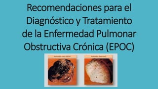 Recomendaciones para el
Diagnóstico y Tratamiento
de la Enfermedad Pulmonar
Obstructiva Crónica (EPOC)
 
