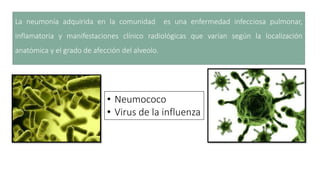 La neumonía adquirida en la comunidad es una enfermedad infecciosa pulmonar,
inflamatoria y manifestaciones clínico radiológicas que varían según la localización
anatómica y el grado de afección del alveolo.
• Neumococo
• Virus de la influenza
 