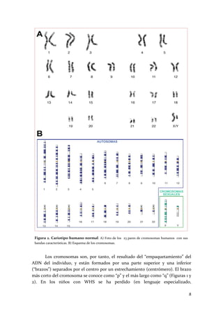  
    Figura 2. Cariotipo humano normal. A) Foto de los  23 pares de cromosomas humanos  con sus 
    bandas características. B) Esquema de los cromosomas. 



       Los  cromosomas  son,  por  tanto,  el  resultado  del  “empaquetamiento”  del 
ADN  del  individuo,  y  están  formados  por  una  parte  superior  y  una  inferior 
(“brazos”) separados por el centro por un estrechamiento (centrómero). El brazo 
más corto del cromosoma se conoce como “p” y el más largo como “q” (Figuras 1 y 
2).  En  los  niños  con  WHS  se  ha  perdido  (en  lenguaje  especializado, 

                                                                                                  8 
 
 