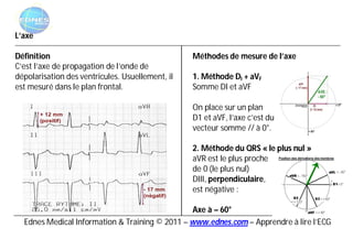 L’axe

Définition                                        Méthodes de mesure de l’axe
C’est l’axe de propagation de l’onde de
dépolarisation des ventricules. Usuellement, il   1. Méthode DI + aVF
est mesuré dans le plan frontal.                  Somme DI et aVF

                                                  On place sur un plan
                                                  D1 et aVF, l’axe c’est du
                                                  vecteur somme // à 0°.

                                                  2. Méthode du QRS « le plus nul »
                                                  aVR est le plus proche
                                                  de 0 (le plus nul)
                                                  DIII, perpendiculaire,
                                                  est négative :

                                                Axe à – 60°
  Ednes Medical Information & Training © 2011 – www.ednes.com – Apprendre à lire l’ECG
 
