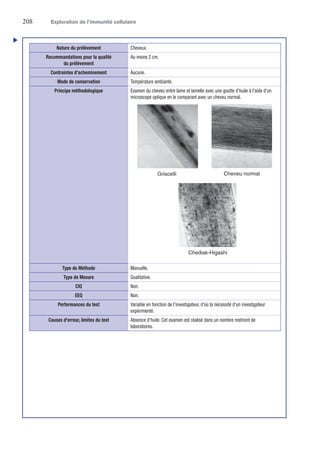 208	 Exploration de l’immunité cellulaire
u
Cheveu normal
Chediak-Higashi
Griscelli
Nature du prélèvement Cheveux.
Recommandations pour la qualité
du prélèvement
Au moins 2 cm.
Contraintes d'acheminement Aucune.
Mode de conservation Température ambiante.
Principe méthodologique Examen du cheveu entre lame et lamelle avec une goutte d'huile à l'aide d'un
microscope optique en le comparant avec un cheveu normal.
Type de Méthode Manuelle.
Type de Mesure Qualitative.
CIQ Non.
EEQ Non.
Performances du test Variable en fonction de l'investigateur, d'où la nécessité d'un investigateur
expérimenté.
Causes d'erreur, limites du test Absence d'huile. Cet examen est réalisé dans un nombre restreint de
laboratoires.
 