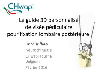 Le guide 3D personnalisé
de visée pédiculaire
pour fixation lombaire postérieure
Dr M Triffaux
Neurochirurgie
CHwapi Tournai
Belgium
Février 2016
 