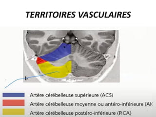 TERRITOIRES VASCULAIRES
 