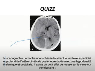 QUIZZ
 