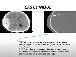 CAS CLINIQUE
 