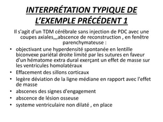INTERPRÉTATION TYPIQUE DE
L’EXEMPLE PRÉCÉDENT 1
Il s'agit d'un TDM cérébrale sans injection de PDC avec une
coupes axiales,,,abscence de reconstruction , en fenêtre
parenchymateuse :
• objectivant une hyperdensité spontanée en lentille
biconvexe pariétal droite limité par les sutures en faveur
d'un hématome extra dural exerçant un effet de masse sur
les ventricules homolatéraux
• Effacement des sillons corticaux
• legère déviation de la ligne médiane en rapport avec l'effet
de masse
• abscenes des signes d'engagement
• abscence de lésion osseuse
• systeme ventriculaire non dilaté , en place
 
