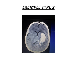 EXEMPLE TYPE 2
 