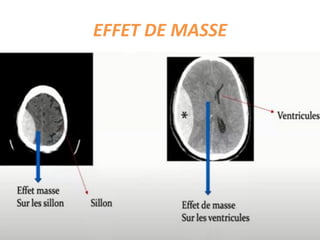 EFFET DE MASSE
 