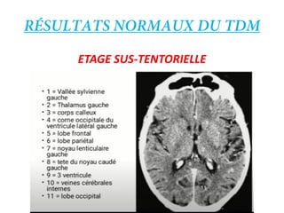 ETAGE SUS-TENTORIELLE
 
