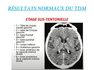 ETAGE SUS-TENTORIELLE
 