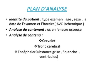PLAN D'ANALYSE
• identité du patient : type examen , age , sexe , la
date de l’examen et l’horaire( AVC ischemique )
• Analyse du contenant : os en fenetre osseuse
• Analyse de contenu :
Cervelet
Tronc cerebral
Encéphale(Substance grise , Sblanche ,
ventricules)
 