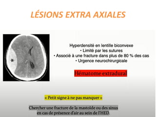LÉSIONS EXTRA AXIALES
 