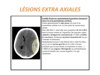 LÉSIONS EXTRA AXIALES
 