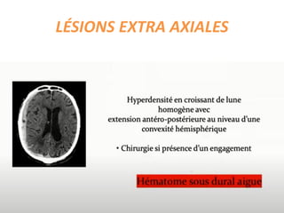 LÉSIONS EXTRA AXIALES
 