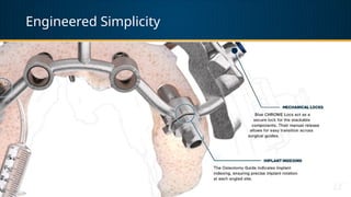 Engineered Simplicity
 