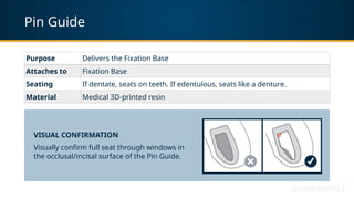 Pin Guide
Purpose Delivers the Fixation Base
Attaches to Fixation Base
Seating If dentate, seats on teeth. If edentulous, seats like a denture.
Material Medical 3D-printed resin
VISUAL CONFIRMATION
Visually confirm full seat through windows in
the occlusal/incisal surface of the Pin Guide.
 