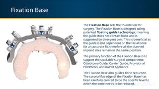 Fixation Base
The Fixation Base sets the foundation for
surgery. The Fixation Base is designed using
patented floating guide technology; meaning
the guide does not contact bone and is
supported by divergent pins. This is beneficial as
the guide is not dependent on the facial bone
for an accurate fit, therefore all the planned
implant sites remain in the same position.
The primary function of the Fixation Base is to
support the stackable surgical components:
Osteotomy Guide, Carrier Guide, Provisional
Prosthesis, and RAPID Appliance.
The Fixation Base also guides bone reduction.
The coronal flat edge of the Fixation Base has
been carefully created to be the specific level to
which the bone needs to be reduced.
 