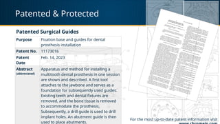 Patented & Protected
Patented Surgical Guides
For the most up-to-date patent information visit
Purpose Fixation base and guides for dental
prosthesis installation
Patent No. 11173016
Patent
Date
Feb. 14, 2023
Abstract
(abbreviated)
Apparatus and method for installing a
multitooth dental prosthesis in one session
are shown and described. A first tool
attaches to the jawbone and serves as a
foundation for subsequently used guides.
Existing teeth and dental fixtures are
removed, and the bone tissue is removed
to accommodate the prosthesis.
Subsequently, a drill guide is used to drill
implant holes. An abutment guide is then
used to place abutments.
 