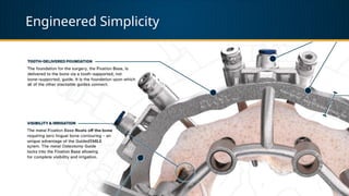 Engineered Simplicity
 