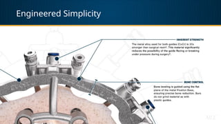 Engineered Simplicity
 