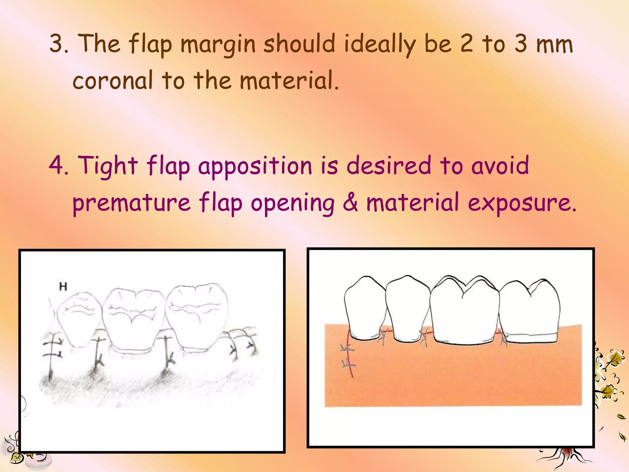 3. The flap margin should ideally be 2 to 3 mm
  coronal to the material.


4. Tight flap apposition is desired to avoid
  premature flap opening & material exposure.
 