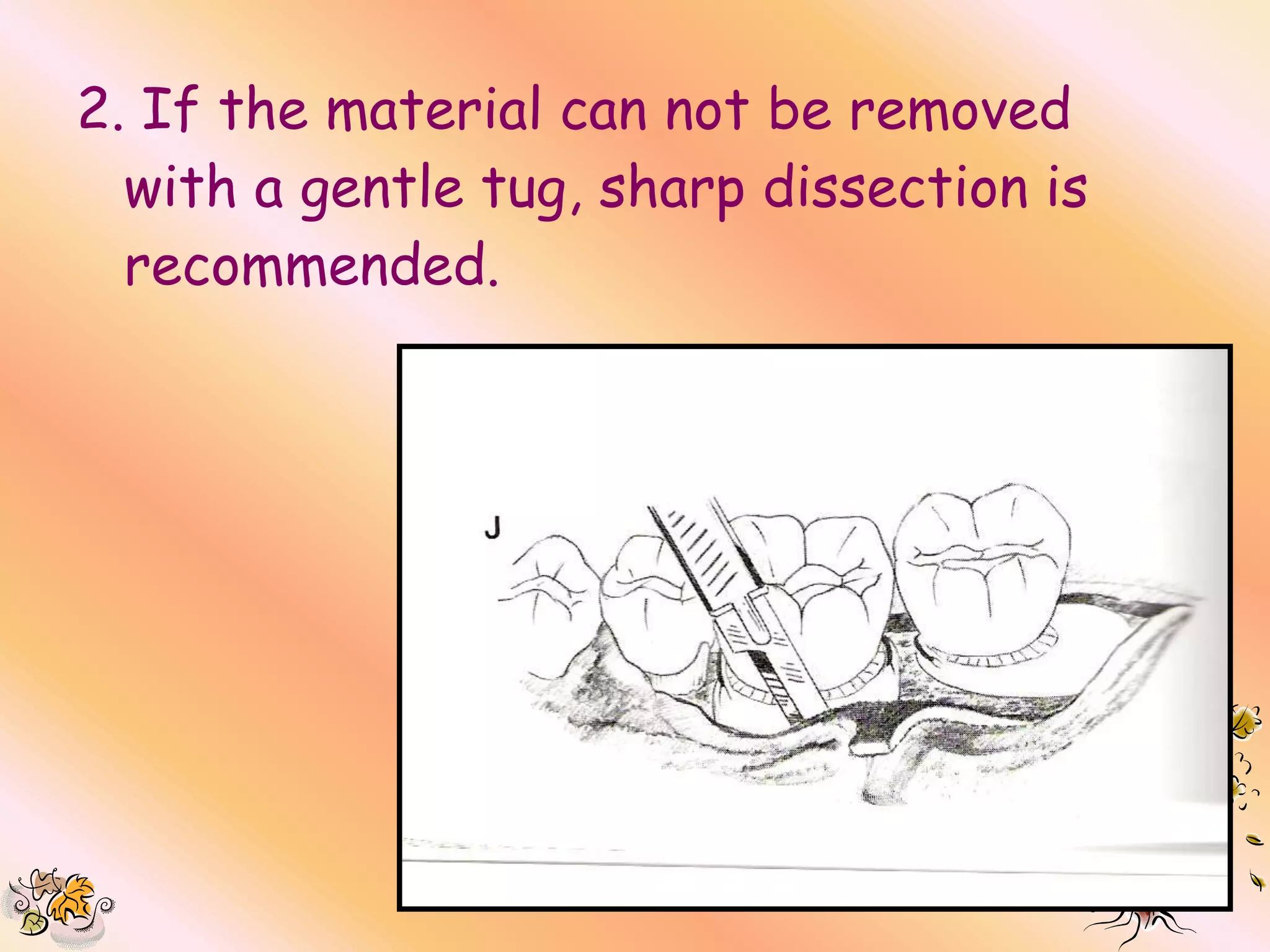 2. If the material can not be removed
  with a gentle tug, sharp dissection is
  recommended.
 