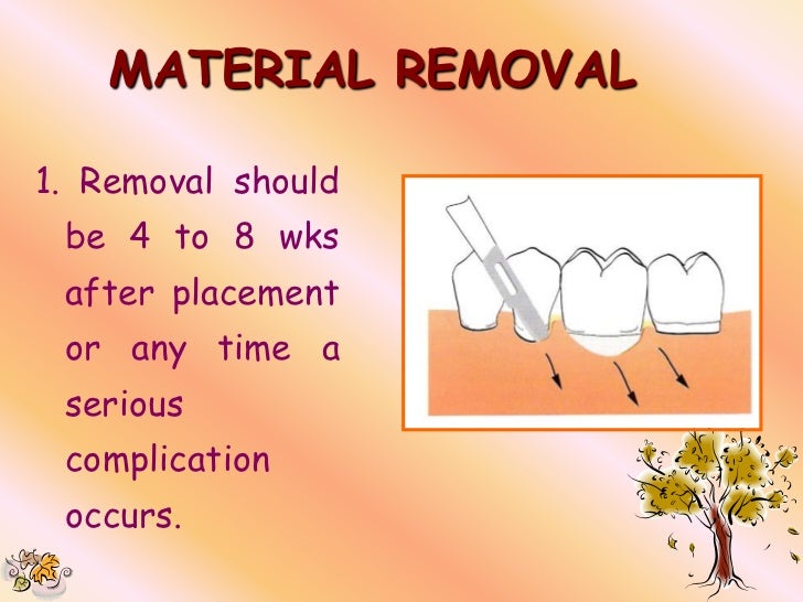Guided Tissue Regeneration Guided tissue regeneration