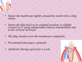 • Suture the membrane tightly around the tooth with a sling
suture.
• Suture the flap back in its original position or slightly
coronal to it, using independent sutures interdentally and
in the vertical incisions.
• The flap should cover the membrane completely.
• Periodontal dressing is optional.
• Antibiotic therapy given for a week.
 