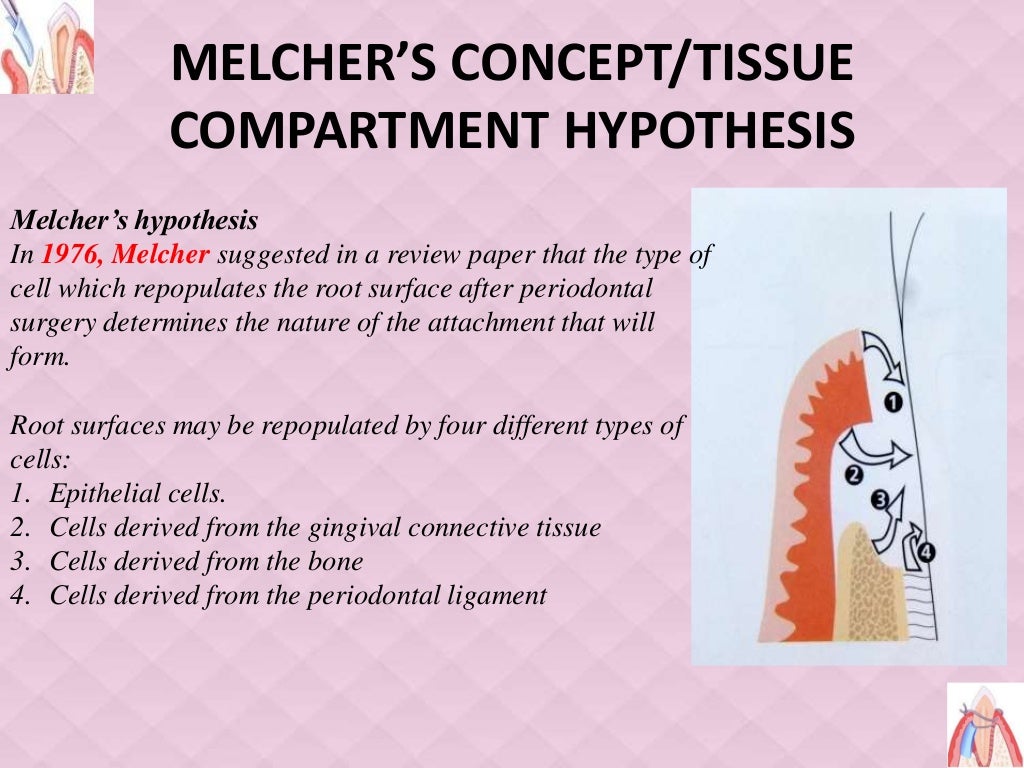 "GUIDED TISSUE REGENERATION"