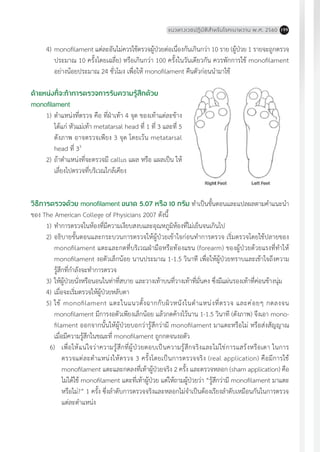 แนวทางเวชปฏิบัติส�ำหรับโรคเบาหวาน พ.ศ. 2560 199
4)	monofilament แต่ละอันไม่ควรใช้ตรวจผู้ป่วยต่อเนื่องกันเกินกว่า 10 ราย (ผู้ป่วย 1 รายจะถูกตรวจ
ประมาณ 10 ครั้งโดยเฉลี่ย) หรือเกินกว่า 100 ครั้งในวันเดียวกัน ควรพักการใช้ monofilament
อย่างน้อยประมาณ 24 ชั่วโมง เพื่อให้ monofilament คืนตัวก่อนน�ำมาใช้
ต�ำแหน่งที่จะท�ำการตรวจการรับความรู้สึกด้วย
monofilament
1)	ต�ำแหน่งที่ตรวจ คือ ที่ฝ่าเท้า 4 จุด ของเท้าแต่ละข้าง
ได้แก่ หัวแม่เท้า metatarsal head ที่ 1 ที่ 3 และที่ 5
ดังภาพ อาจตรวจเพียง 3 จุด โดยเว้น metatarsal
head ที่ 33
2)	ถ้าต�ำแหน่งที่จะตรวจมี callus แผล หรือ แผลเป็น ให้
เลี่ยงไปตรวจที่บริเวณใกล้เคียง
วิธีการตรวจด้วย monofilament ขนาด 5.07 หรือ 10 กรัม ท�ำเป็นขั้นตอนและแปลผลตามค�ำแนะน�ำ
ของ The American College of Physicians 2007 ดังนี้
1)	ท�ำการตรวจในห้องที่มีความเงียบสงบและอุณหภูมิห้องที่ไม่เย็นจนเกินไป
2)	อธิบายขั้นตอนและกระบวนการตรวจให้ผู้ป่วยเข้าใจก่อนท�ำการตรวจ เริ่มตรวจโดยใช้ปลายของ
monofilament แตะและกดที่บริเวณฝ่ามือหรือท้องแขน (forearm) ของผู้ป่วยด้วยแรงที่ท�ำให้
monofilament งอตัวเล็กน้อย นานประมาณ 1-1.5 วินาที เพื่อให้ผู้ป่วยทราบและเข้าใจถึงความ
รู้สึกที่ก�ำลังจะท�ำการตรวจ
3)	ให้ผู้ป่วยนั่งหรือนอนในท่าที่สบาย และวางเท้าบนที่วางเท้าที่มั่นคง ซึ่งมีแผ่นรองเท้าที่ค่อนข้างนุ่ม
4)	เมื่อจะเริ่มตรวจให้ผู้ป่วยหลับตา
5)	ใช้ monofilament แตะในแนวตั้งฉากกับผิวหนังในต�ำแหน่งที่ตรวจ และค่อยๆ กดลงจน
monofilament มีการงอตัวเพียงเล็กน้อย แล้วกดค้างไว้นาน 1-1.5 วินาที (ดังภาพ) จึงเอา mono-
filament ออกจากนั้นให้ผู้ป่วยบอกว่ารู้สึกว่ามี monofilament มาแตะหรือไม่ หรือส่งสัญญาณ
เมื่อมีความรู้สึกในขณะที่ monofilament ถูกกดจนงอตัว
	 6)	 เพื่อให้แน่ใจว่าความรู้สึกที่ผู้ป่วยตอบเป็นความรู้สึกจริงและไม่ใช่การแสร้งหรือเดา ในการ
ตรวจแต่ละต�ำแหน่งให้ตรวจ 3 ครั้งโดยเป็นการตรวจจริง (real application) คือมีการใช้
monofilament แตะและกดลงที่เท้าผู้ป่วยจริง 2 ครั้ง และตรวจหลอก (sham application) คือ
ไม่ได้ใช้ monofilament แตะที่เท้าผู้ป่วย แต่ให้ถามผู้ป่วยว่า “รู้สึกว่ามี monofilament มาแตะ
หรือไม่?” 1 ครั้ง ซึ่งล�ำดับการตรวจจริงและหลอกไม่จ�ำเป็นต้องเรียงล�ำดับเหมือนกันในการตรวจ
แต่ละต�ำแหน่ง
 