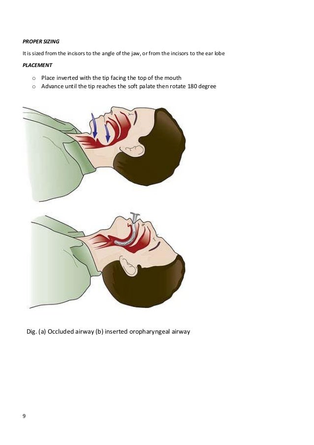 Guideline for airway management3