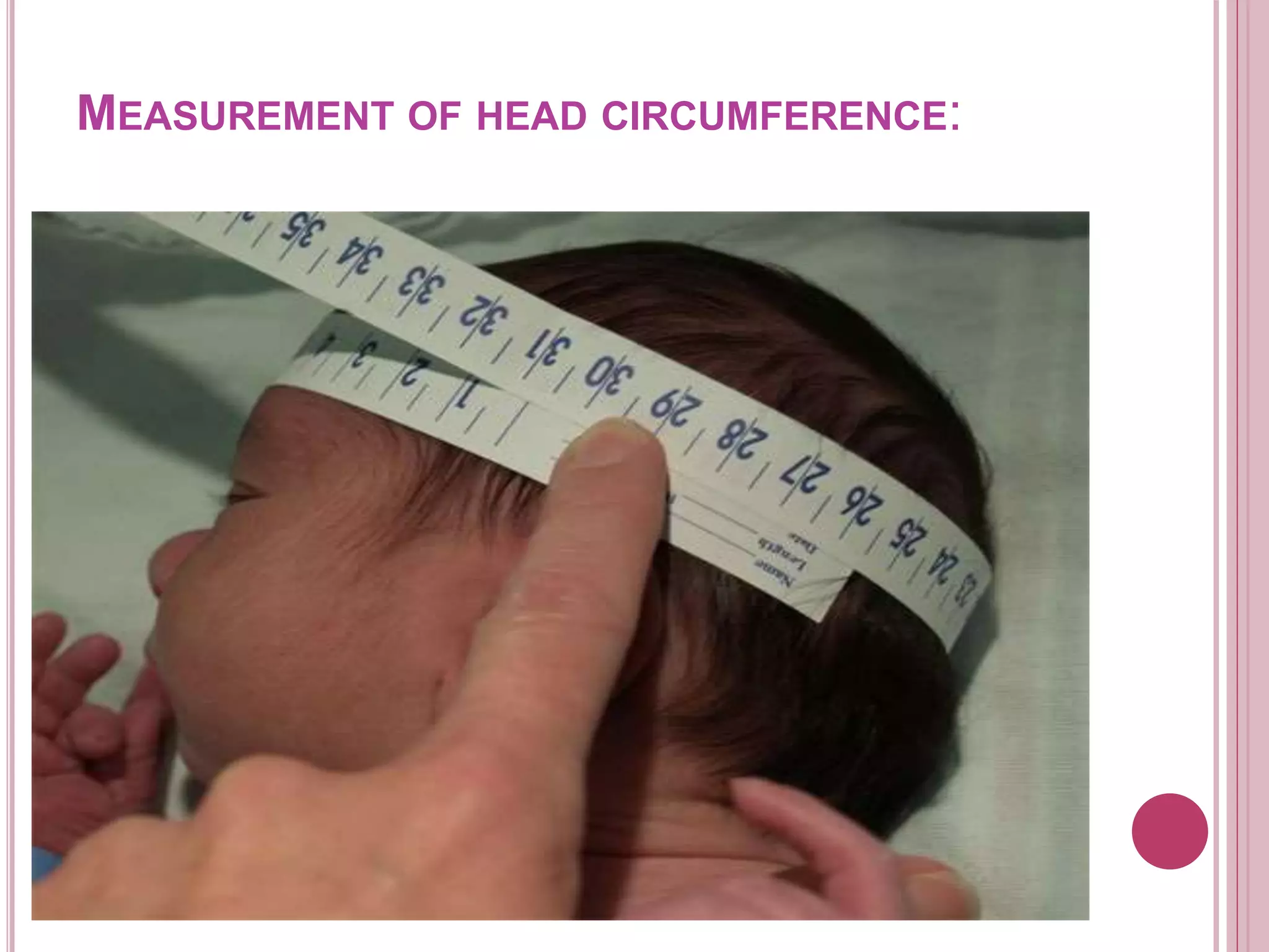 MEASUREMENT OF HEAD CIRCUMFERENCE:
 