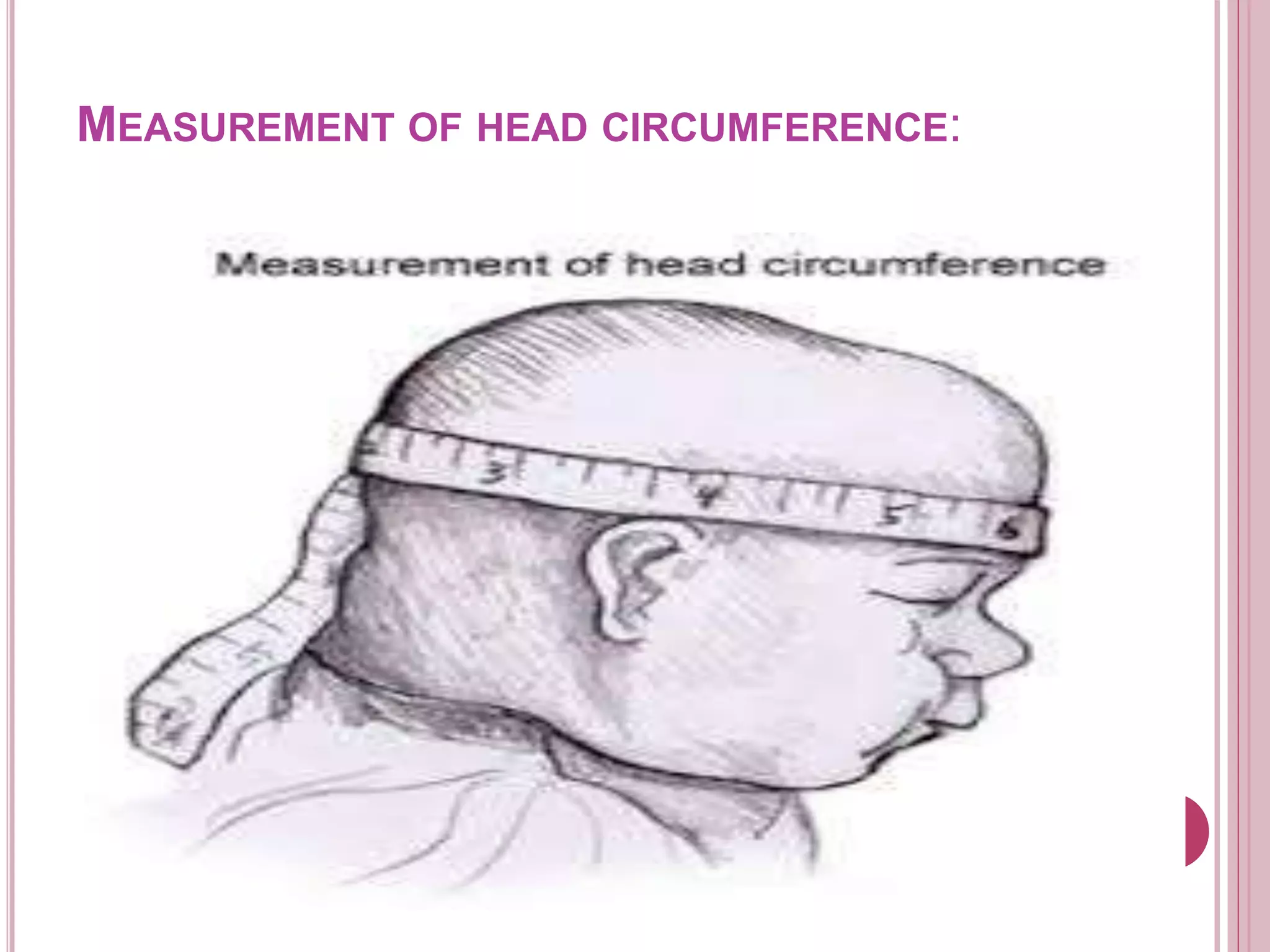 MEASUREMENT OF HEAD CIRCUMFERENCE:
 