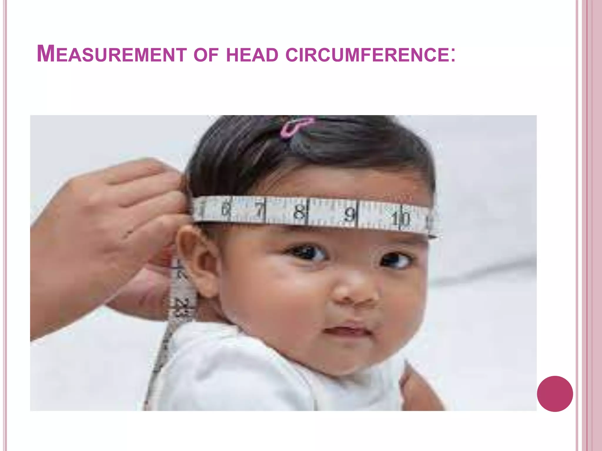 MEASUREMENT OF HEAD CIRCUMFERENCE:
 