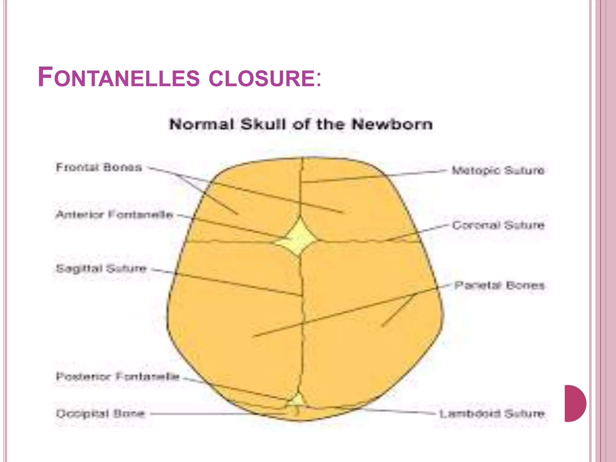 FONTANELLES CLOSURE:
 