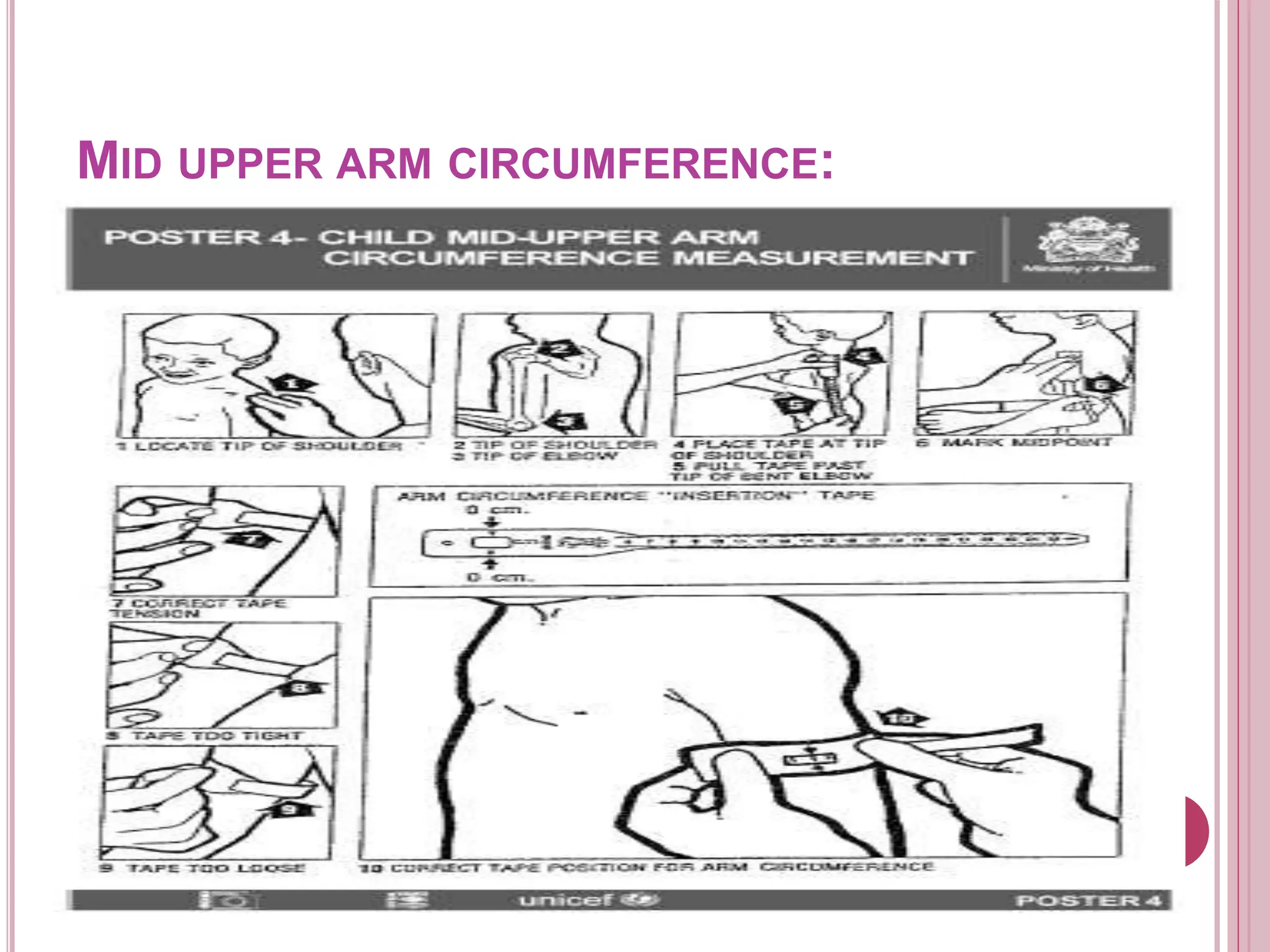 MID UPPER ARM CIRCUMFERENCE:
 