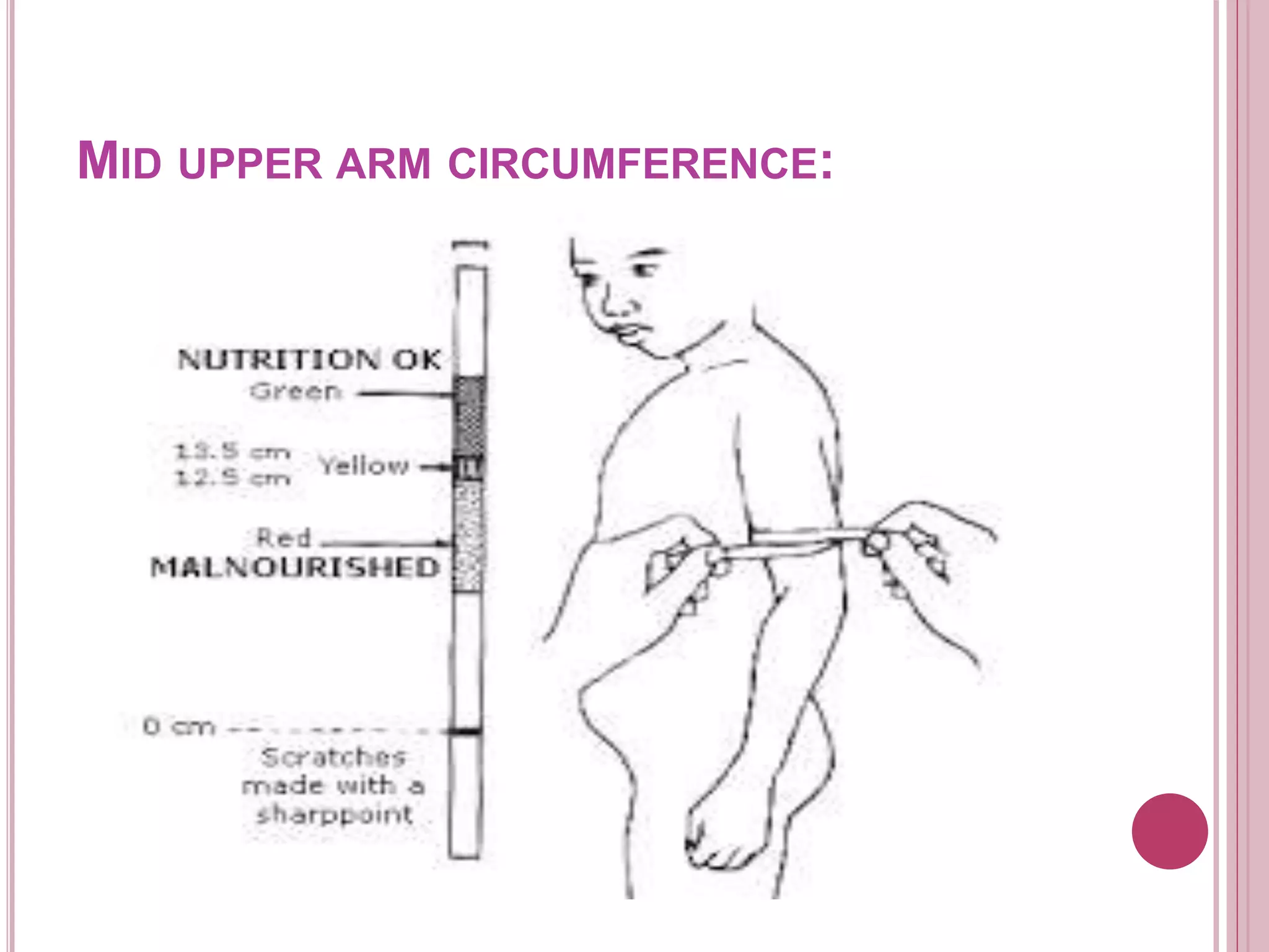 MID UPPER ARM CIRCUMFERENCE:
 